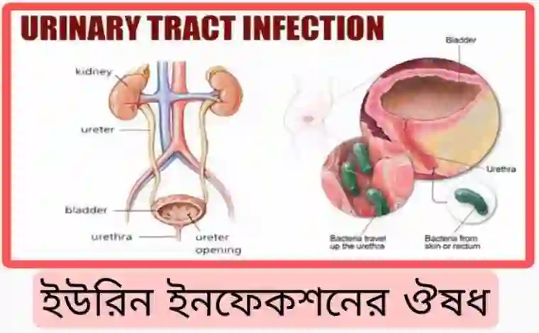 ইউরিন ইনফেকশনের ঔষধের নাম [নিয়ম ও পার্শ্বপ্রতিক্রিয়া]